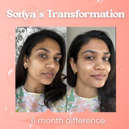 CtrlGirl™ Lipo Gluta Drops